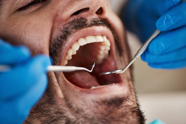 Best Emergency Denture Repair in Broomall, PA